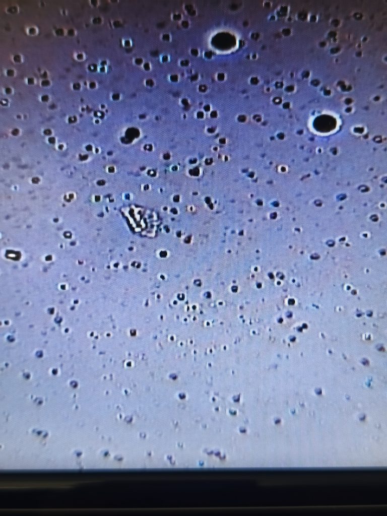 Cristales compatibles con estruvita observados al microscopio en sedimento urinario de un paciente felino en Clínica Veterinaria Aragón