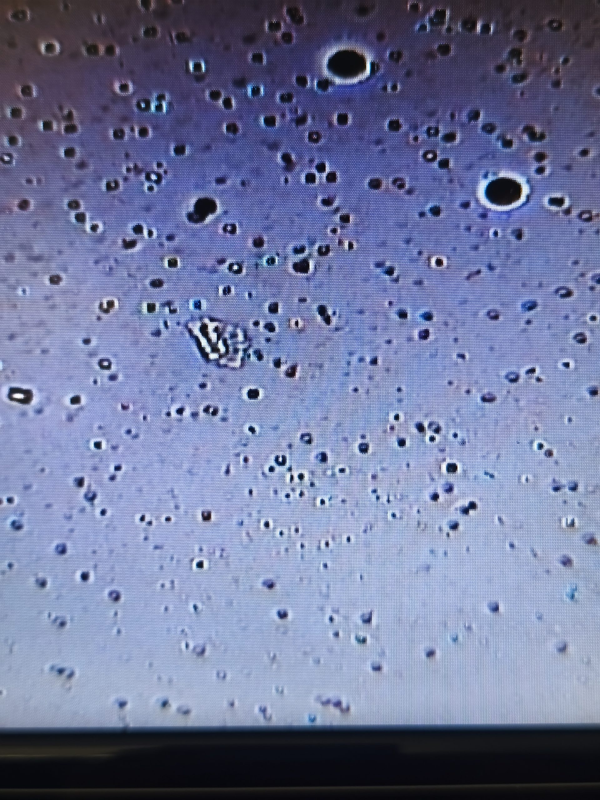 Cristales compatibles con estruvita observados al microscopio en sedimento urinario de un paciente felino en Clínica Veterinaria Aragón